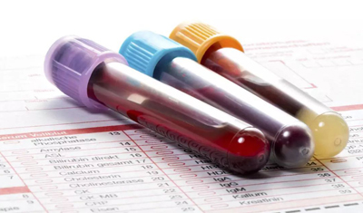 给年老者输入年轻血液真的可以延缓衰老吗? 给年老者输入年轻血液真的可以延缓衰老吗?