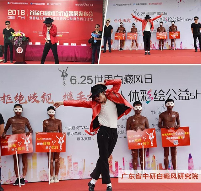 “拒绝歧视•携手抗白”6.25世界白癜风日公益骑行活动凝聚大爱 传递温暖 “拒绝歧视•携手抗白”6.25世界白癜风日公益骑行活动凝聚大爱 传递温暖