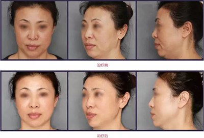 1544406361853909.png 3.png