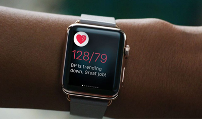 苹果和强生合作,研究Apple Watch预防中风 苹果和强生合作,研究Apple Watch预防中风