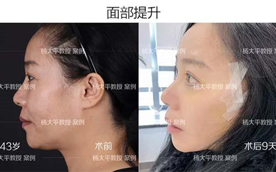 1550213264495129.jpeg 2.jpeg