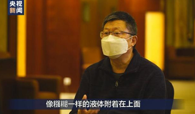 首例新冠肺炎尸检报告发布:肺已经不是肺了! 首例新冠肺炎尸检报告发布:肺已经不是肺了!