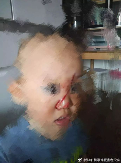 奔驰高管!在华伤人在先,拒赔在后,网友们怒了! 奔驰高管!在华伤人在先,拒赔在后,网友们怒了!